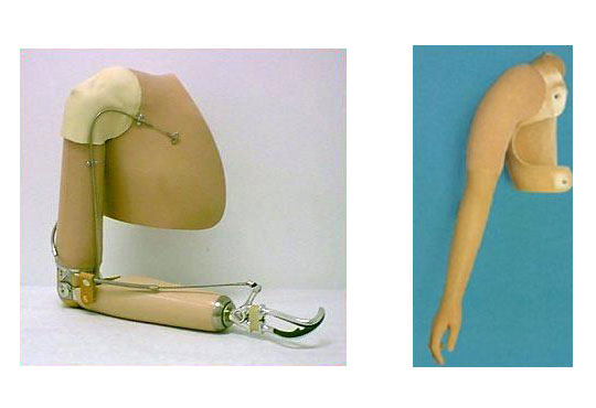 interscapular-thoracic prostheses