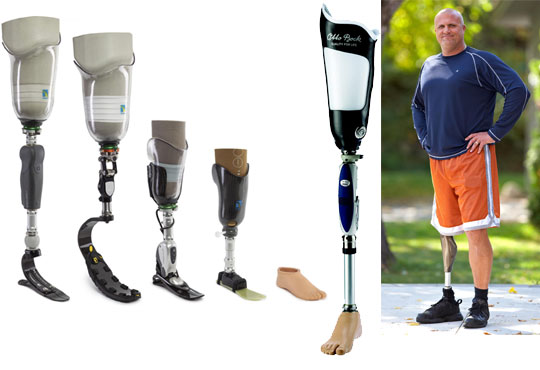 Lower Extremity  Custom Prosthetic Services Ltd.