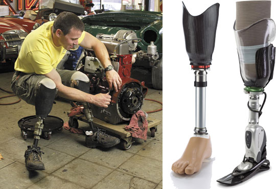 Transtibial Prostheses